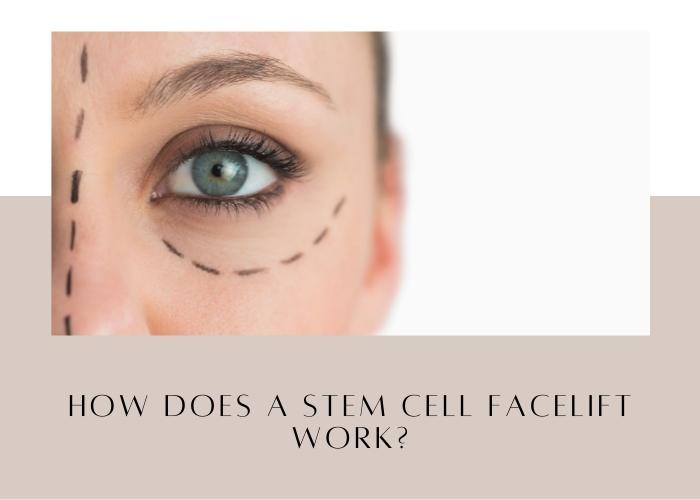 How Does A Stem Cell Facelift Work